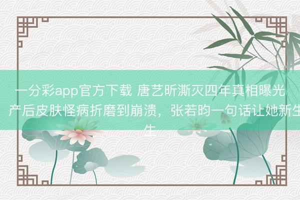 一分彩app官方下载 唐艺昕澌灭四年真相曝光！产后皮肤怪病折磨到崩溃，张若昀一句话让她新生